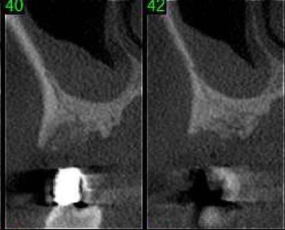 CBCT slice